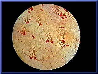 Typhoid